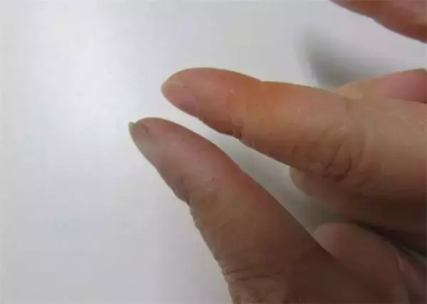 你吃的是枸杞還是毒藥,不妨做個實驗來看看