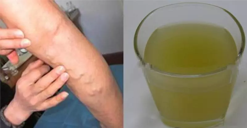一天一杯,堅持一個月,打通血管阻塞,血管垃圾清乾淨,為家人收好