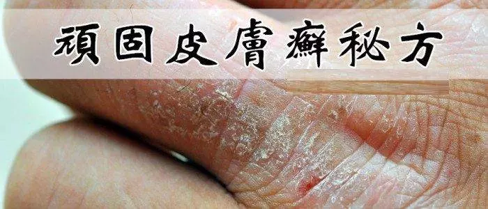 難得一見【治皮膚奇癢很有效的土方】一定要收藏