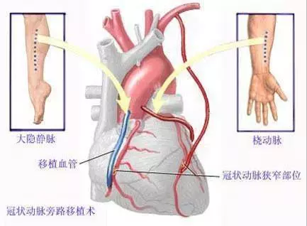 糖尿病足太可怕,很多病人都要截肢!腳上出現3個症狀,趕緊去醫院吧!