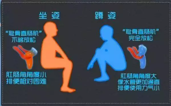越來越多人衛生間不裝馬桶了,現在流行這樣裝