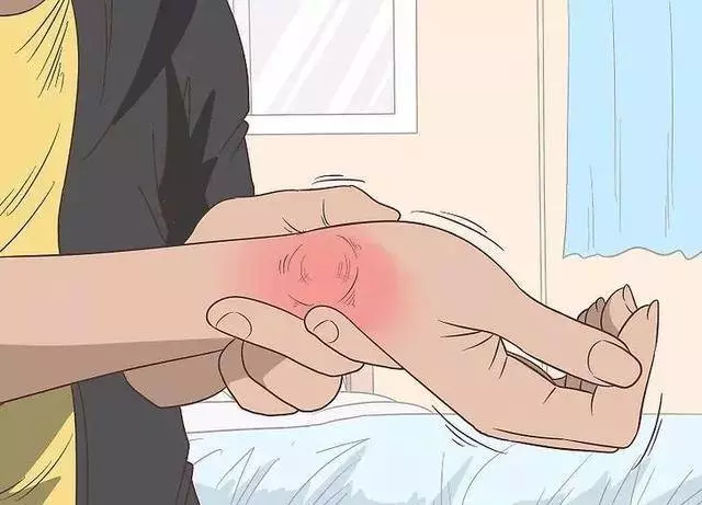 身體3個症狀,說明尿酸已經高的很可怕!謹記【三多、四少】遠離高尿酸
