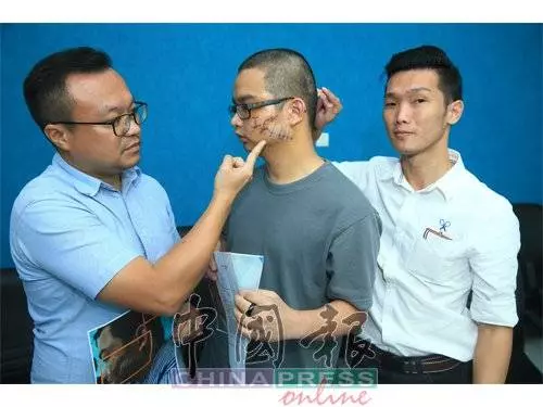 因為嘴癢惹怒對方!一句話換來毒打!青年臉縫了至少100針險!對方要求和解遭拒!誓要討回公道!