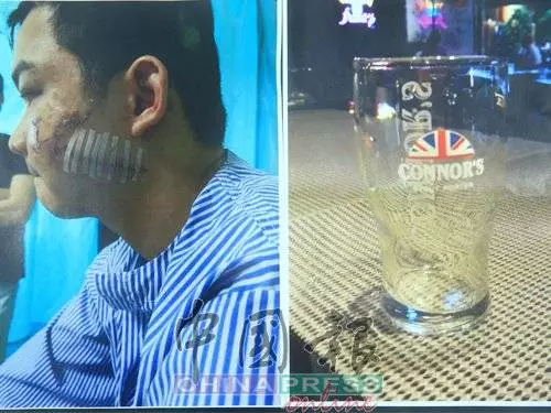 因為嘴癢惹怒對方!一句話換來毒打!青年臉縫了至少100針險!對方要求和解遭拒!誓要討回公道!