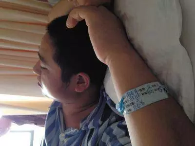 糖尿病初期有哪些癥兆?第一個表現最容易發現,別再忽視了