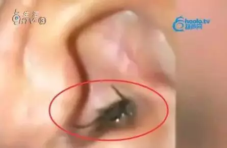 嚇死人!蜈蚣竟躲在女孩築巢,只因床邊放了這個東西!這個習慣其實很多人都有……太可怕了!!