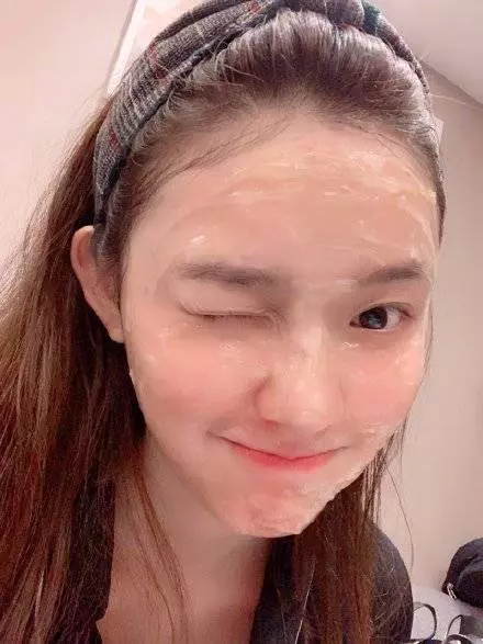 《美人魚》林允去整牙了!瘦了7公斤後臉走形, 顴骨突出令,網友不敢置信:丑到~