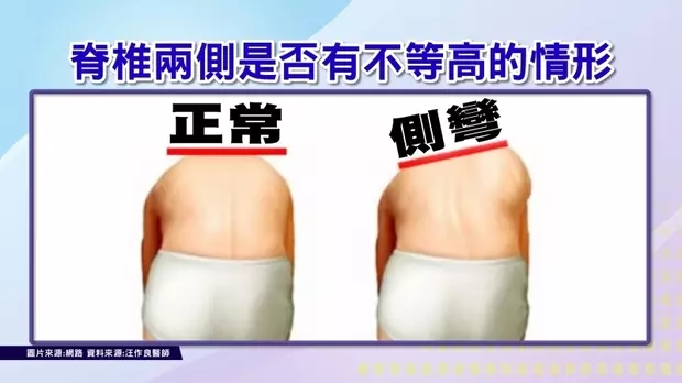 莫名「腰痛、肩頸痛」?恐「脊椎側彎」龍骨大走山!三招改善痠痛