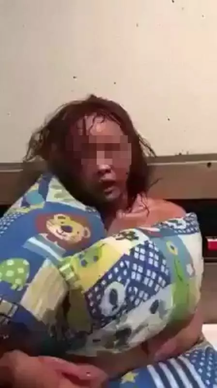 一個很愛自己女友的男生會把對方打成豬頭嗎?漂亮的臉蛋被打成豬頭,連眼睛都看不到!網民:「阿媽都唔認得」