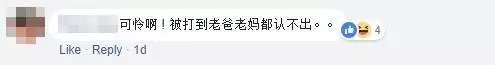 一個很愛自己女友的男生會把對方打成豬頭嗎?漂亮的臉蛋被打成豬頭,連眼睛都看不到!網民:「阿媽都唔認得」