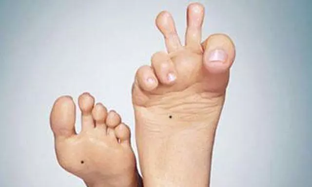 腎臟好或壞,「看腳」就知道!