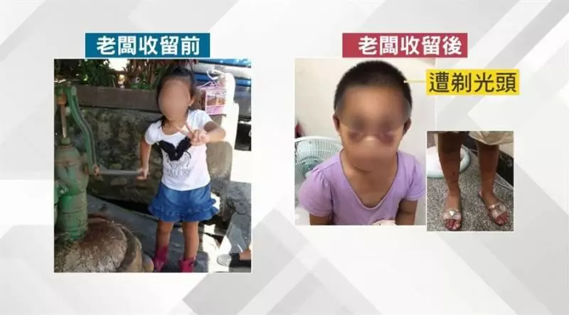 5歲女童遭糟蹋虐打變禿頭 鄰居「雞婆」看一眼才救了女孩的命!