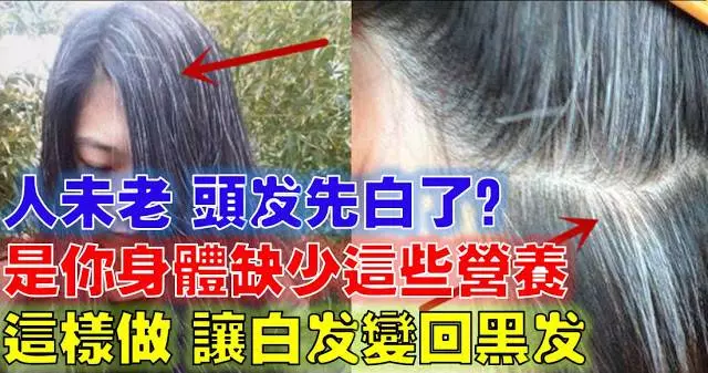 人未老頭髮就白了?原來是你的身體缺少某些營養素!「這麼做」讓白髮變回黑髮哦!!