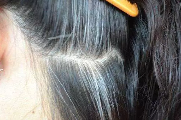 人未老頭髮就白了?原來是你的身體缺少某些營養素!「這麼做」讓白髮變回黑髮哦!!