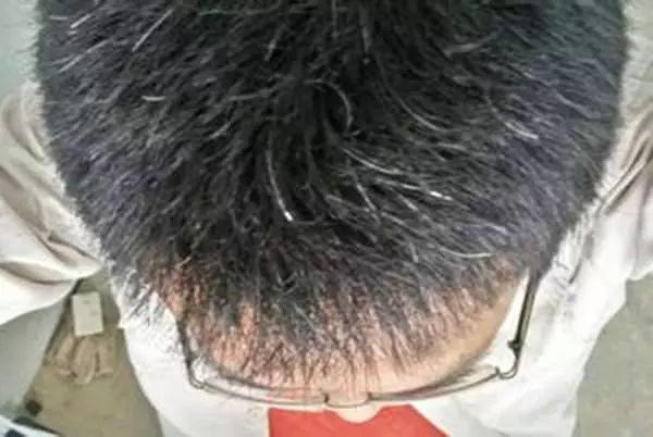 人未老頭髮就白了?原來是你的身體缺少某些營養素!「這麼做」讓白髮變回黑髮哦!!