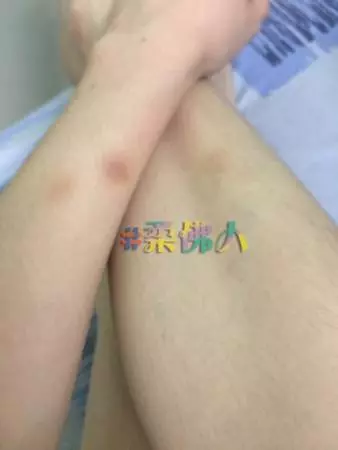 ◤事件曝光了◢ 被打3次分手【前男友網絡霸凌還討錢】網民轟爆渣男