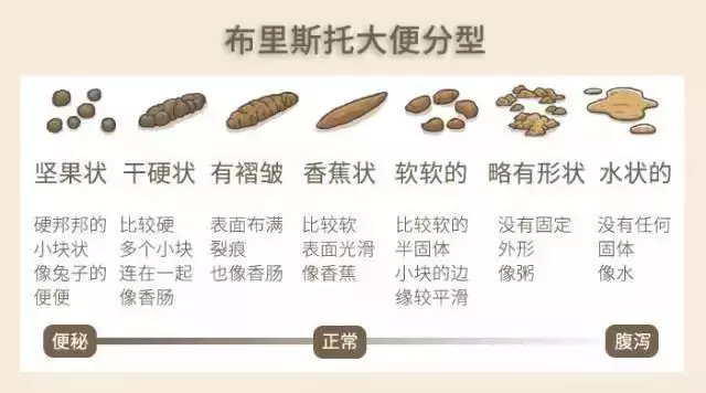 每天在這2個「時間點」排便的人,若沒有3種表現,恭喜你,說明你的腸道很健康