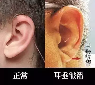 身體出現這7個信號,竟是心臟在求救!送你十個強心秘訣,遠離心臟病