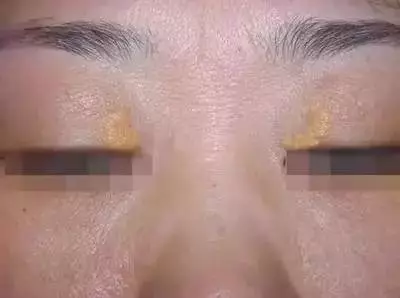 身體出現這7個信號,竟是心臟在求救!送你十個強心秘訣,遠離心臟病