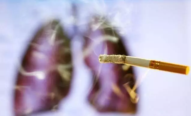 呼吸科主任提醒:身體有這5種表現,當心是肺癌早期症狀,第4個表現最容易發現,別再忽視了!