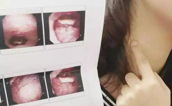 新加坡:女教師咖啡店買到「加料」的麻辣香鍋,4天後喉嚨紅腫又發燒!