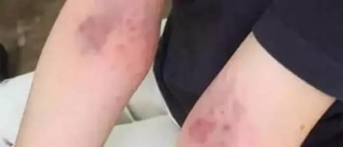 你身上有1個【排毒開關】,每天拍打5分鐘,濕毒、血毒、肝毒、腎毒都少了,少看醫生少吃藥!