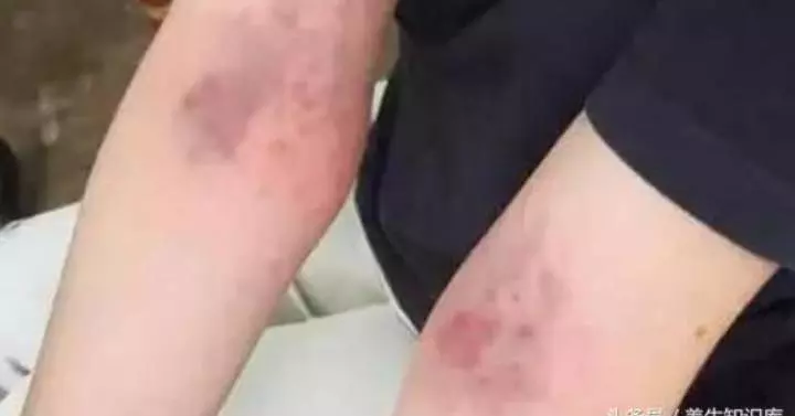 你身上有1個【排毒開關】,每天拍打5分鐘,濕毒、血毒、肝毒、腎毒都少了,少看醫生少吃藥!