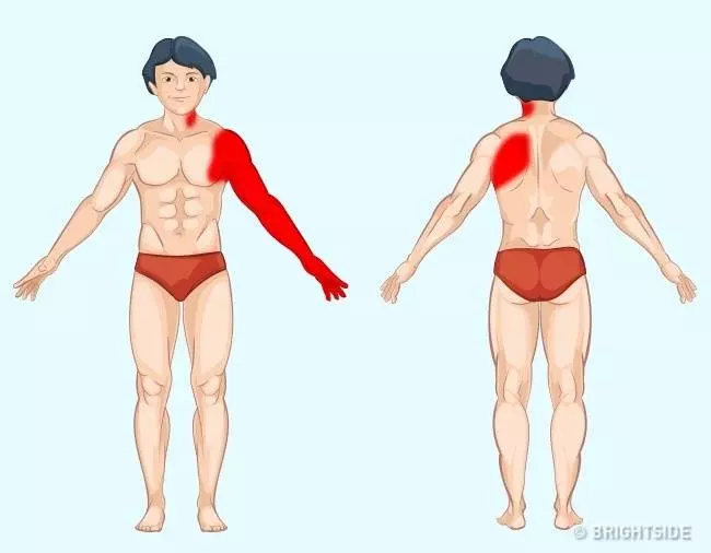 9張圖解「讓你秒懂身體部位會疼痛的原因」,現在就找出問題瞭解原因出在哪裡!