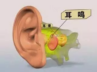 選對方法,耳鳴不再可怕,治療耳鳴變得簡單! 推薦15種偏方 (供參考)