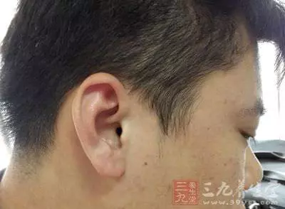 選對方法,耳鳴不再可怕,治療耳鳴變得簡單! 推薦15種偏方 (供參考)