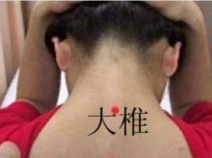 脖子後面長了個「富貴包」,中醫生叫我去買點黃豆,沒想到竟然治好了