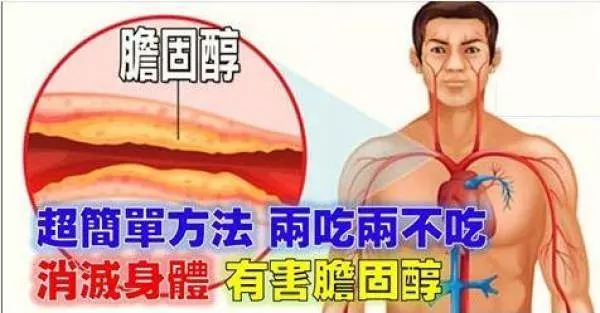 如何消滅身體裡「有害膽固醇」?超簡單方法「兩吃兩不吃」,從此遠離心血管病和肥胖!
