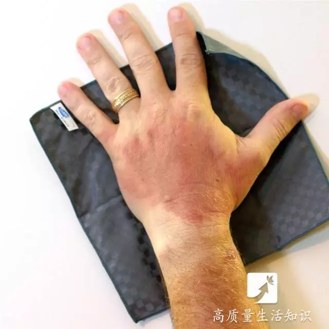 被燙傷了千萬別用牙膏抹,正確快速的急救方法在這裡!