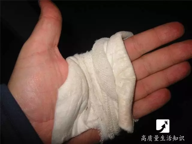 被燙傷了千萬別用牙膏抹,正確快速的急救方法在這裡!