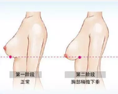 有人凍齡,有人卻顯老氣,身體這9個跡象該拯救了