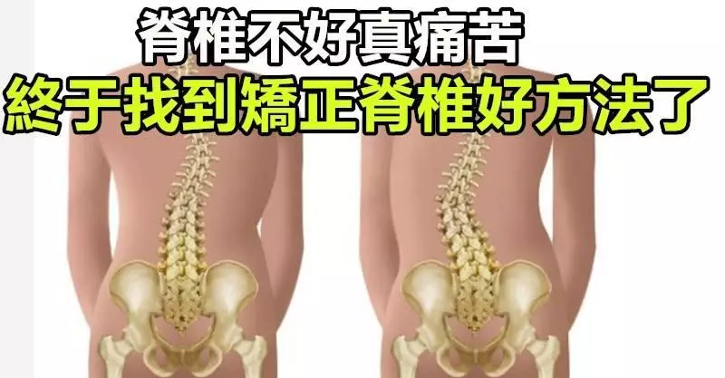 脊椎不好真的好痛苦,特推薦「矯正脊椎」好方法!不吃藥、不打針,簡易可行!