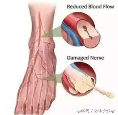 血管老人就老,血管乾淨人不老,簡單三招,通血管、排毒素、更健康!