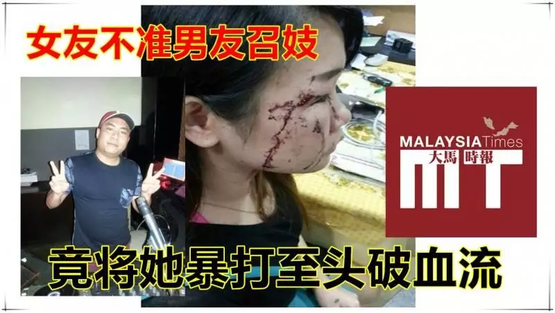 女友不准男友召妓 竟將她暴打至頭破血流