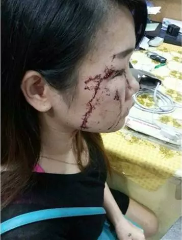 女友不准男友召妓 竟將她暴打至頭破血流