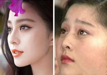肚子大,濕氣重,教你3招祛濕減肥