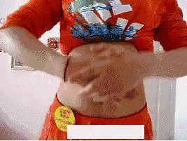 肚子大,濕氣重,教你3招祛濕減肥
