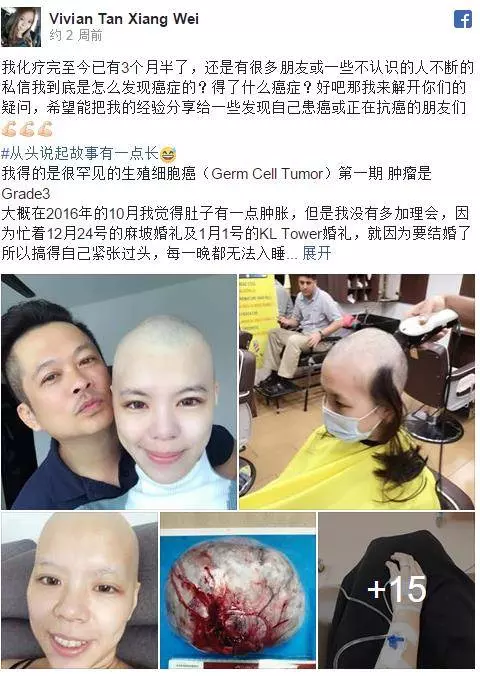 女網友腹部變大,被認為是懷孕了,沒想到竟是血瘤!