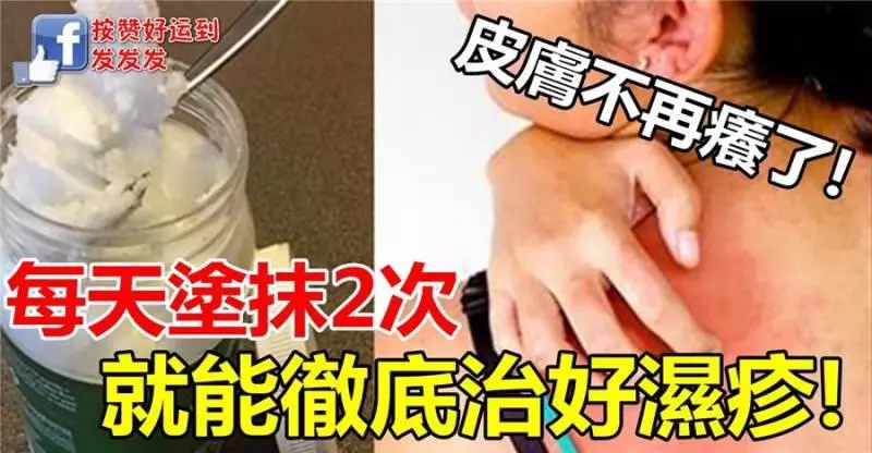 濕疹好難受!只要每天塗抹 2 次,就能徹底治好濕疹!皮膚不再癢了!