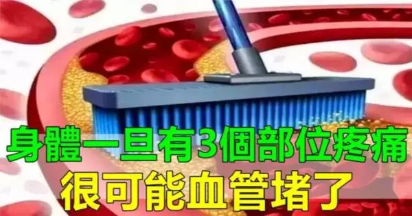 身體一旦有3個部位疼痛,很可能血管堵了!教你4招,通血管,更健康!