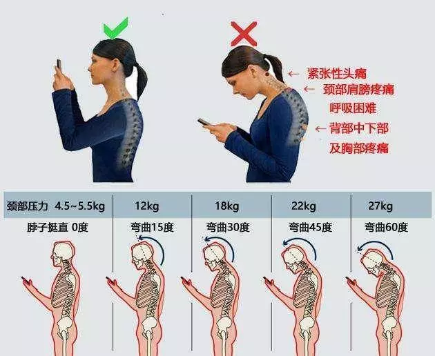 「富貴包」竟然是「奪命包」!幾個簡單瑜伽拉伸,讓你恢復正位!