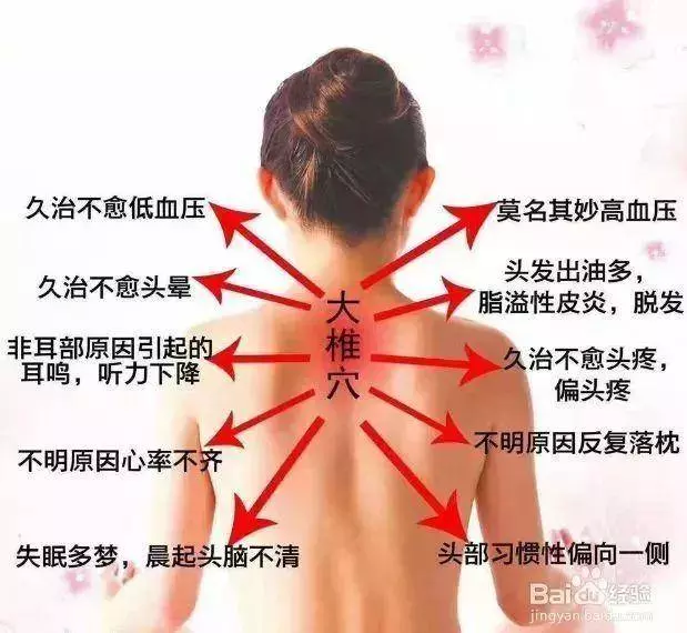 「富貴包」竟然是「奪命包」!幾個簡單瑜伽拉伸,讓你恢復正位!