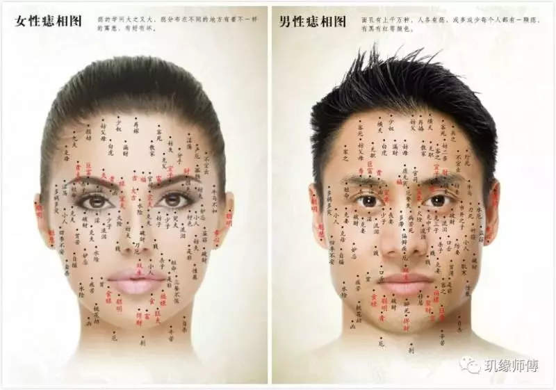 這十處長痣,一生不用愁,這些地方的痣要留著