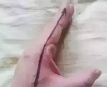 你身上有17個「開關」,一個穴位緩解一種病,按完就舒服了!(值得收好)