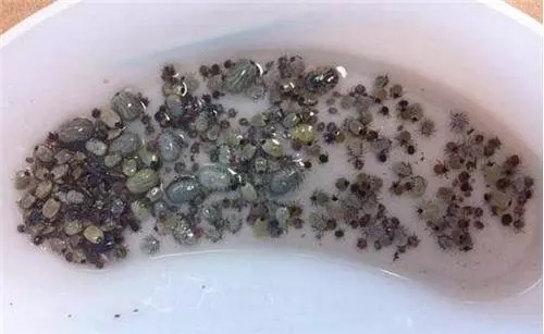 這條蟒蛇是在森林中被一大群不明生物襲擊!遇到好心的路人趕緊將它送醫卻把獸醫給嚇壞了..