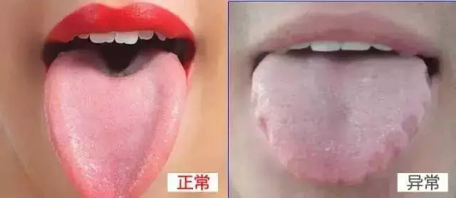 濕氣重!只要每天吃一物,輕鬆排出體內十年濕氣,健康又漂亮!